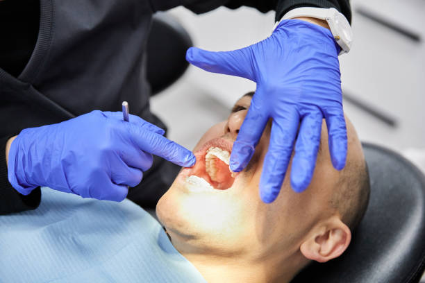 Best Emergency Broken Tooth Repair in Boaz, WV