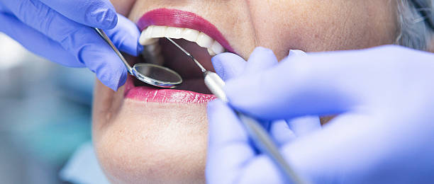 Best Emergency Tooth Extraction in Boaz, WV